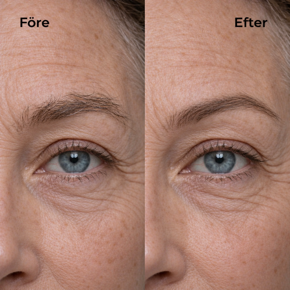 SmoothBeauty - Ansiktshåret borta på bara några sekunder